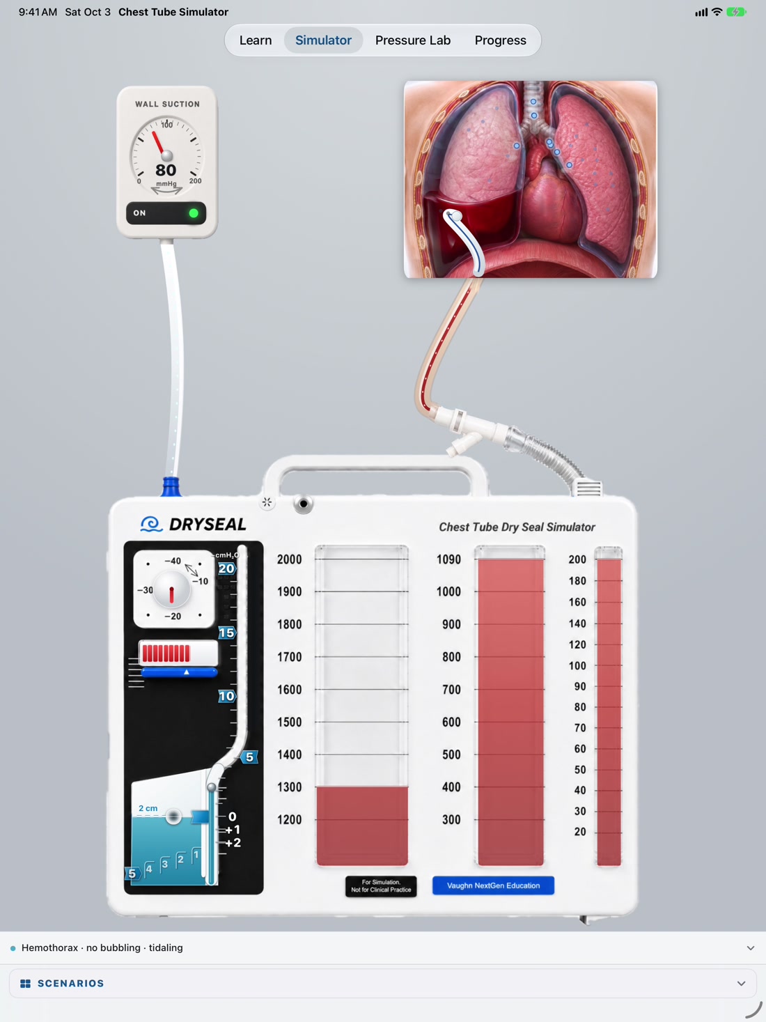 Chest Tube Simulator on iPad with the Scenarios menu collapsed and drainage device fully visible