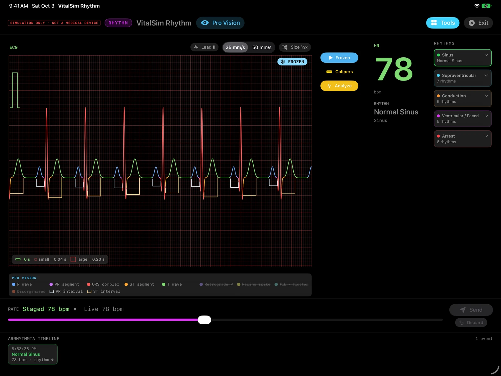 Next-release preview: VitalSim Rhythm on a landscape iPad, showing simulated Normal Sinus at 78 bpm with Pro Vision, ECG component labels and the color key
