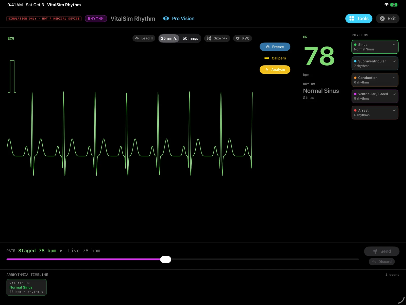 Next-release preview: VitalSim Rhythm on a landscape iPad, showing simulated Normal Sinus at 78 bpm, rhythm categories and the heart-rate slider