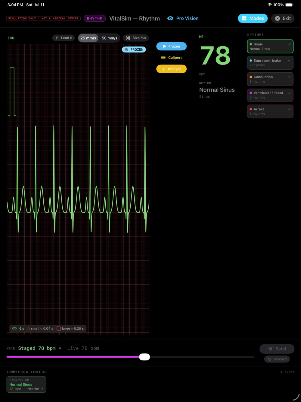 VitalSim Rhythm's live ECG trainer on iPad, showing a frozen Normal Sinus rhythm on a calibrated grid with the heart rate and a rail of the five rhythm families color-coded
